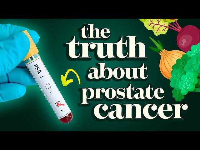 Why Are We Misled About Prostate Cancer? Dr. McDougall's Expert Guide to Beating Prostate Cancer