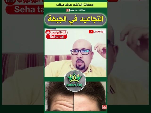 وصفة تجاعيد الجبهة من عند الدكتور عماد ميزاب / #dr_imad_mizab