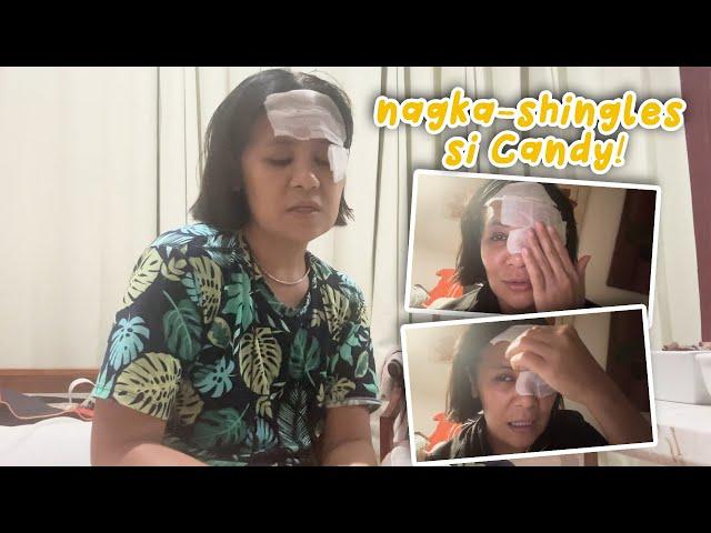 NAGKA-SHINGLES SI CANDY! | CANDY AND QUENTIN | OUR SPECIAL LOVE