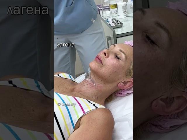 Армирование шеи мезонитями - отличный способ уплотнить, укрепить, подтянуть и омолодить кожу шеи