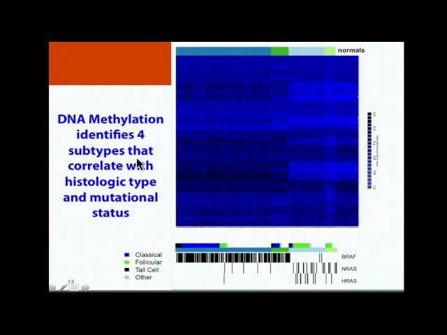 TCGA: Papillary Thyroid Carcinoma Analysis - Thomas Giordano