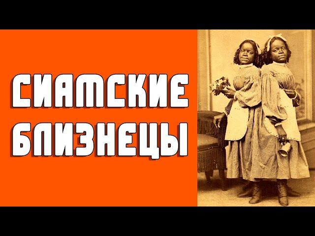 Сестры МакКой - сиамские близнецы