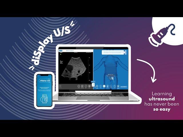 diSplay U/S - Online ultrasound simulator