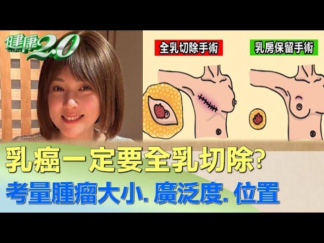 乳癌一定要全乳切除？ 考量腫瘤大小.廣泛度.位置 健康2.0