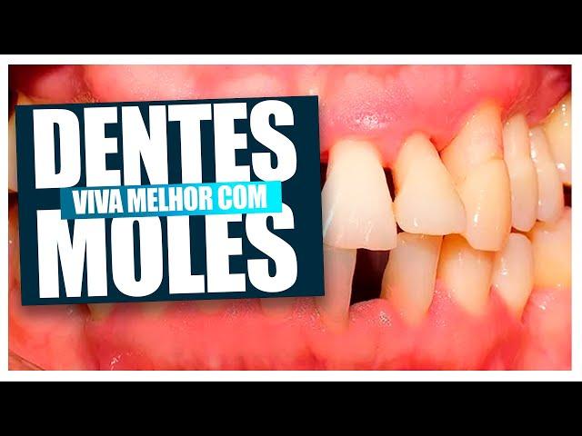 Se você tem Dentes Moles (PERIODONTITE) você precisa assistir esse video