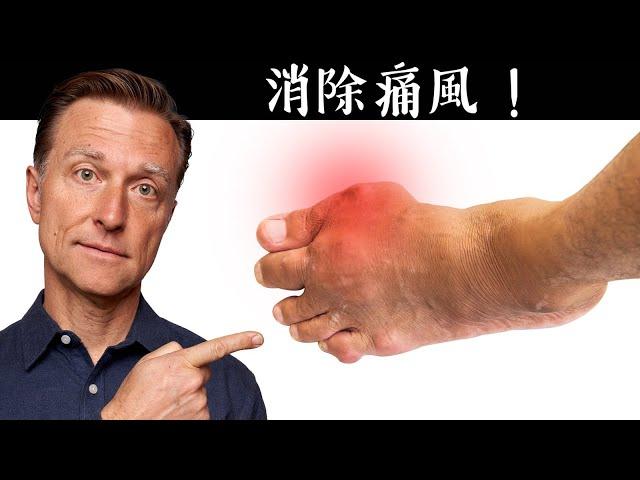 第一名痛風的自然療法,柏格醫生 Dr Berg