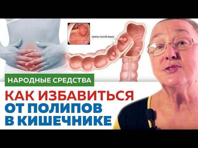 КАК ИЗБАВИТЬСЯ ОТ ПОЛИПОВ в кишечнике || народные средства