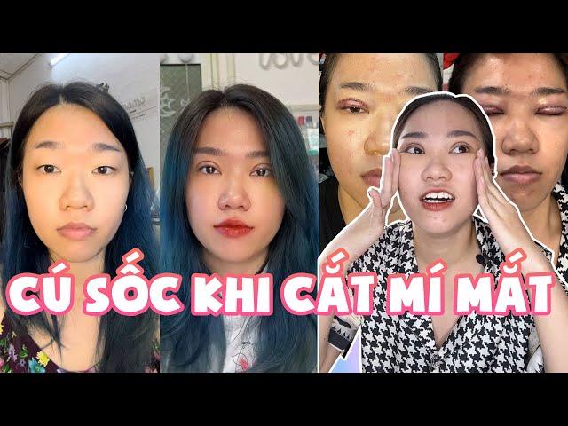 Review CẮT MÍ MẮT siêu chi tiết và cú sốc đầu đời | Momo Review