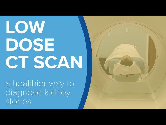Low Dose CT Scans to Detect Kidney Stones - Yale Medicine Explains