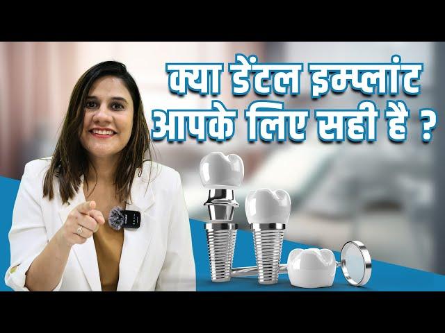 Kya Dental Implants aapke liye right choice hai? What are Dental Implants