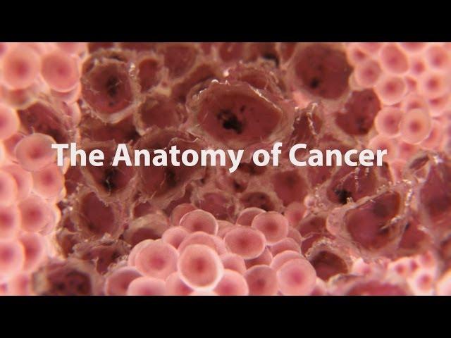 What Is Cancer? What Causes Cancer & How Is It Treated?