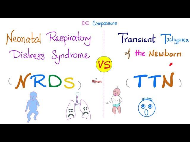 Neonatal Respirtory Distress Syndrome (NRDS) vs Transient Tachypnea of the Newborn (TTN)