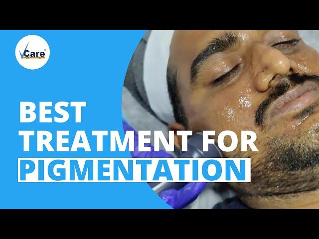 Best Treatment For Pigmentation | Melanin Break Therapy | VCare