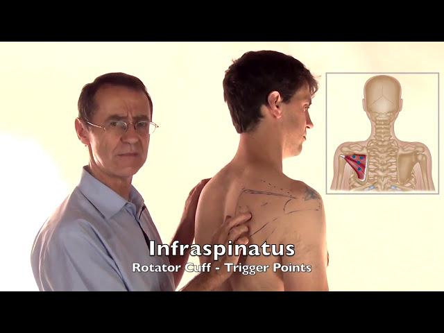 Trigger Point Release - Infraspinatus Muscle