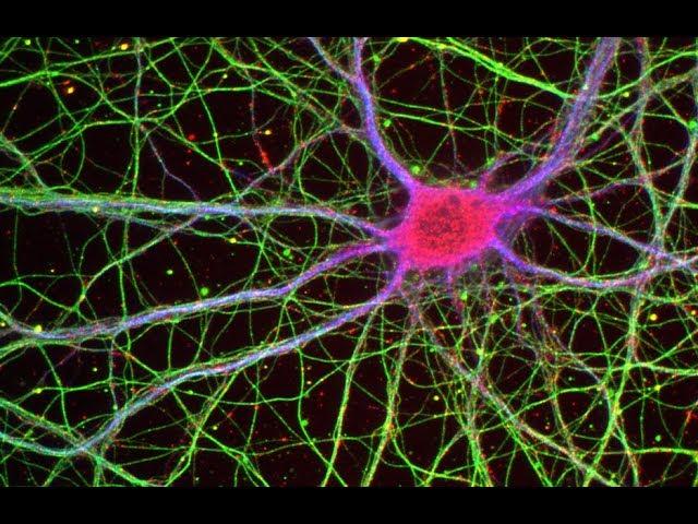 Cell Biology of Neurodegeneration (Part 1)