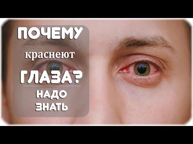 Почему краснеют глаза?