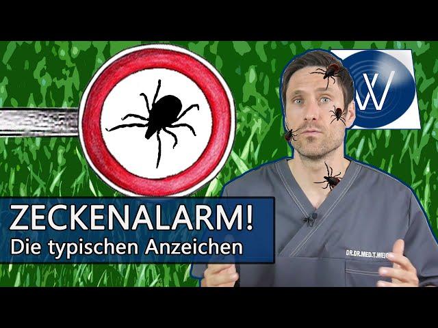 Zecken Alarm! Achten Sie auf diese typischen Alarmzeichen nach Zeckenbiss! Hautrötung, Wanderröte...