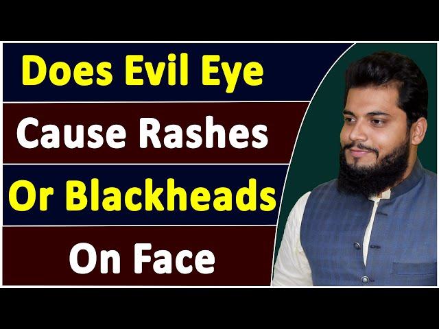 Does Evil Eye Cause Rashes or Blackheads on Human Face | Treatment With Quran | Hafiz Salman | TWQ