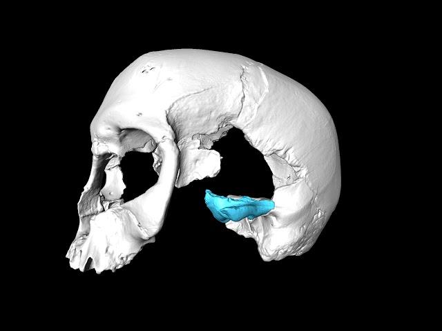 Virtual reconstruction of a 32,000-year-old skull from Cro-Magnon (Dordogne, France)