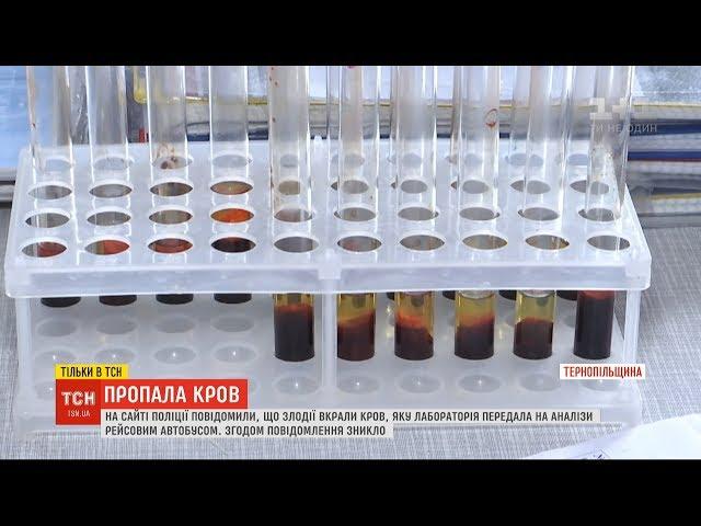 Поліція на Тернопільщині заявила про крадіжку пробірок із кров’ю: куди поділись аналізи
