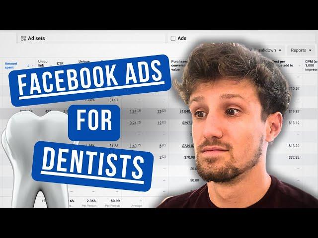 How To Run Facebook Ads (For Dentists) (5 Principles for Success)