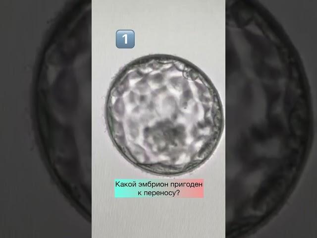 Какой из эмбрионов пригоден к переносу (ответ в описании)