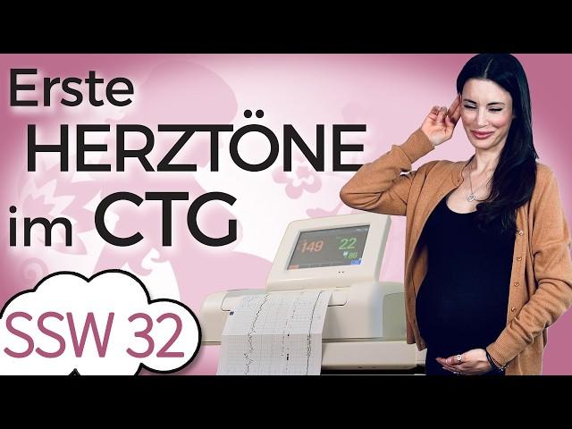 SSW 32: Ich hören den Herzschlag meines Babys | Erstes CTG - Kardiotokographie | Mein Kinderwunsch