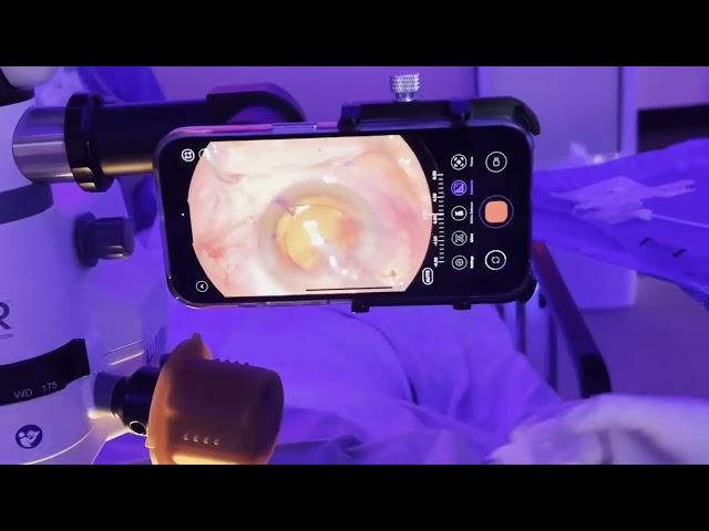 Gulani Vision Institute: Eye Surgery SPA with New 4K System to teach Gulani Techniques worldwide