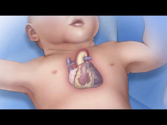 Mayo Clinic Minute: Congenital heart disease and pregnancy