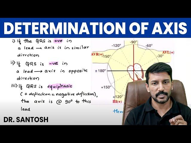 Determination of Axis | Medicine | Master ECG Series with Dr. Santosh | PW MedEd