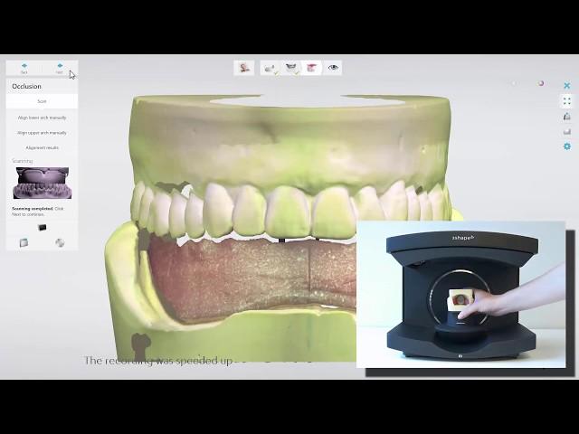 3Shape Dental System - Single Full Denture Scanning Workflow