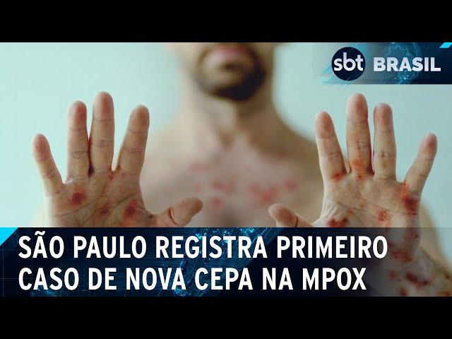 São Paulo confirma primeiro caso de nova cepa da Mpox | SBT Brasil (08/03/25)