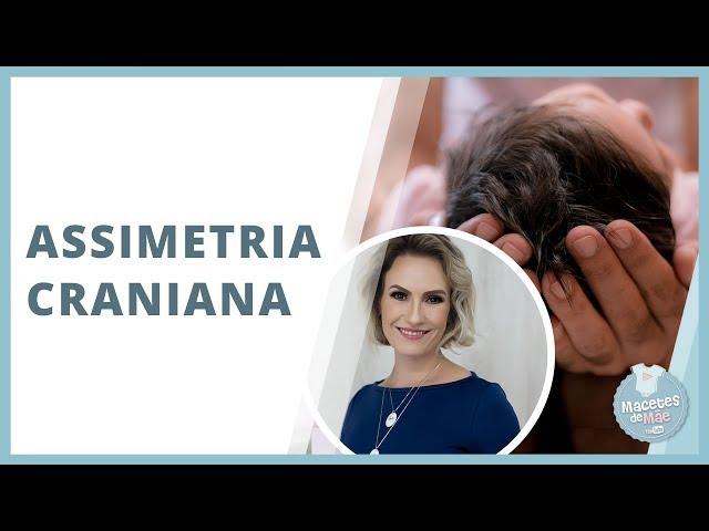 COMO EVITAR QUE A CABEÇA DO BEBÊ FIQUE ACHATADA | MACETES DE MÃE