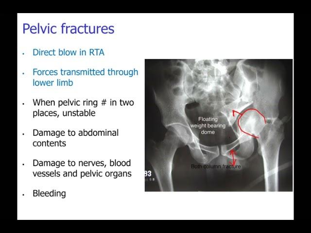 Pelvic Region