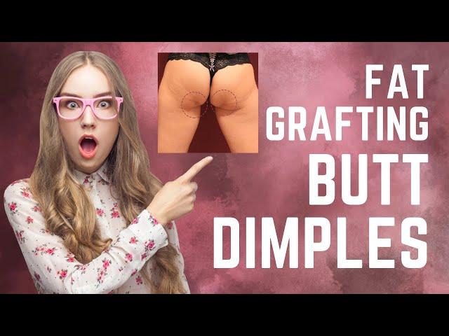 Butt Dimple Correction with Fat Grafting