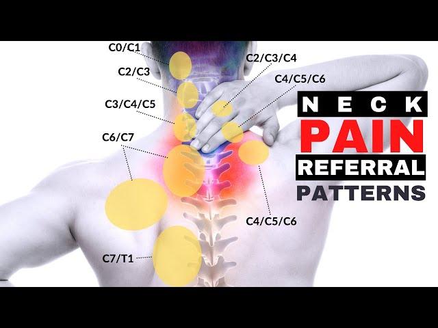 Relieve Shoulder Pain That IS Coming From Your NECK