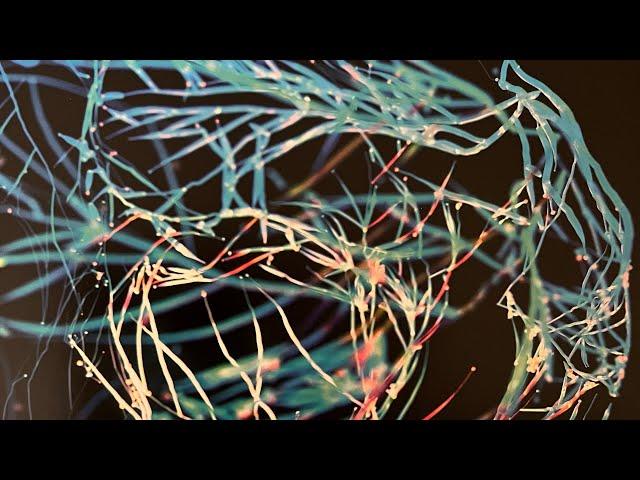 Коротко и ясно: миозит с включениями