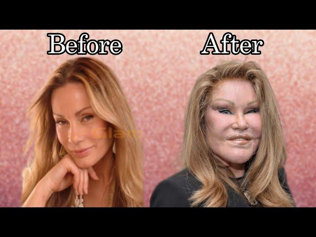 The Story Of JOSELYN WILDENSTEIN (aka Cat woman) | Plastic Surgery, Billionaire marriage and more