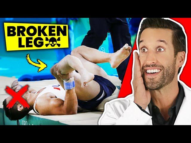 5 MOST PAINFUL Bone Breaks You Can EVER Experience!