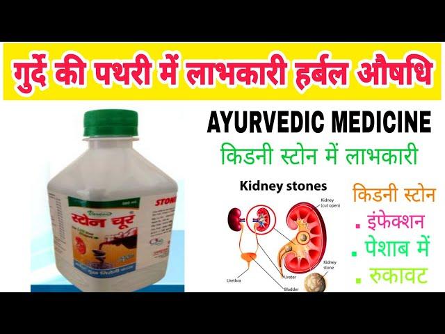 Stone choor natural Ras syrup benefits in Hindi