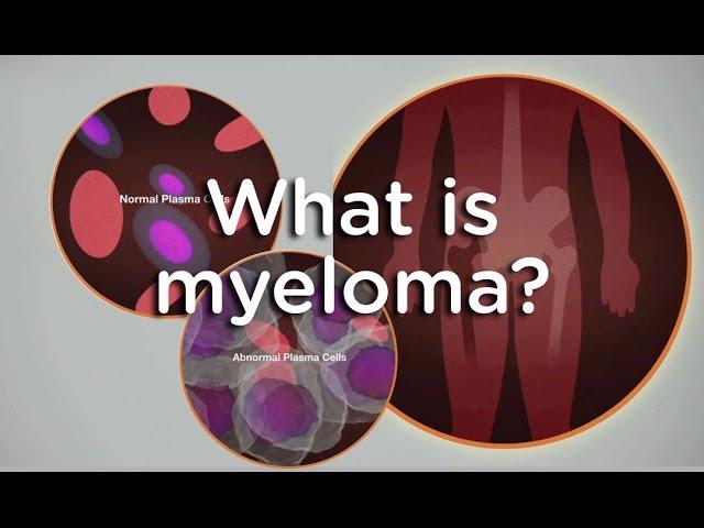 What is myeloma?