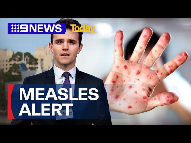 Three cases of measles identified in Victoria | 9 News Australia