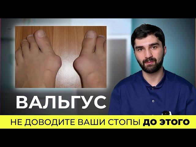 Косточка на стопе: простые решения проблемы!