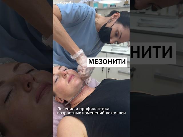 Армирование кожи шеи нитями из полимолочной кислоты