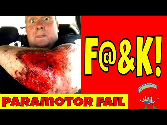 Paramotor Fail - Ouch That Hurt!