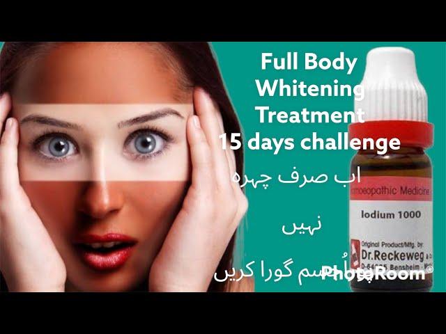 Full Body Whitening Treatment in homeopathy , Iodum 1m , Berberis Aquifolium