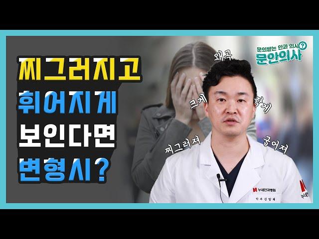 찌그러지고 휘어지게 보인다면 변형시?｜변형시