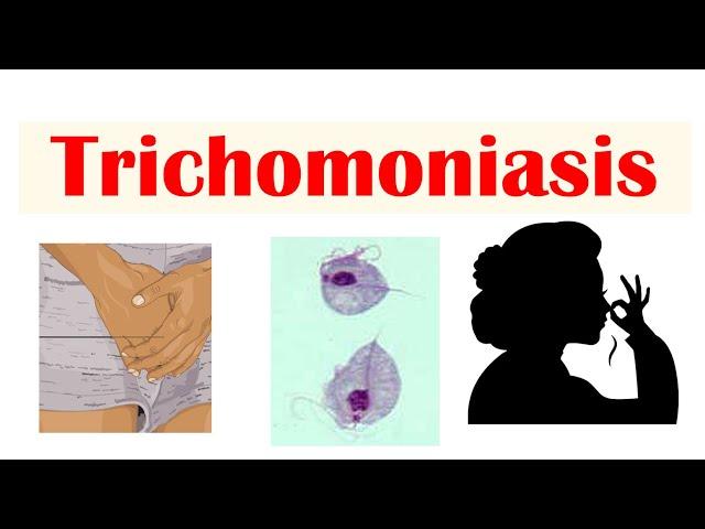 Trichomoniasis (Common STI) | Causes, Symptoms & Complications (Cancer), Diagnosis, Treatment