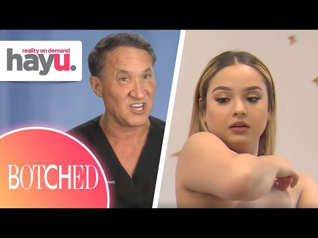 Dr. Dubrow Confirms This The WORST Botched Boob Job EVER! | Season 6 | Botched