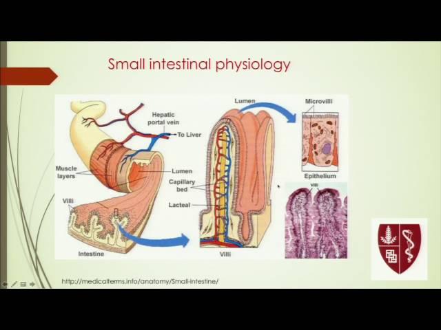 Update on Celiac Disease